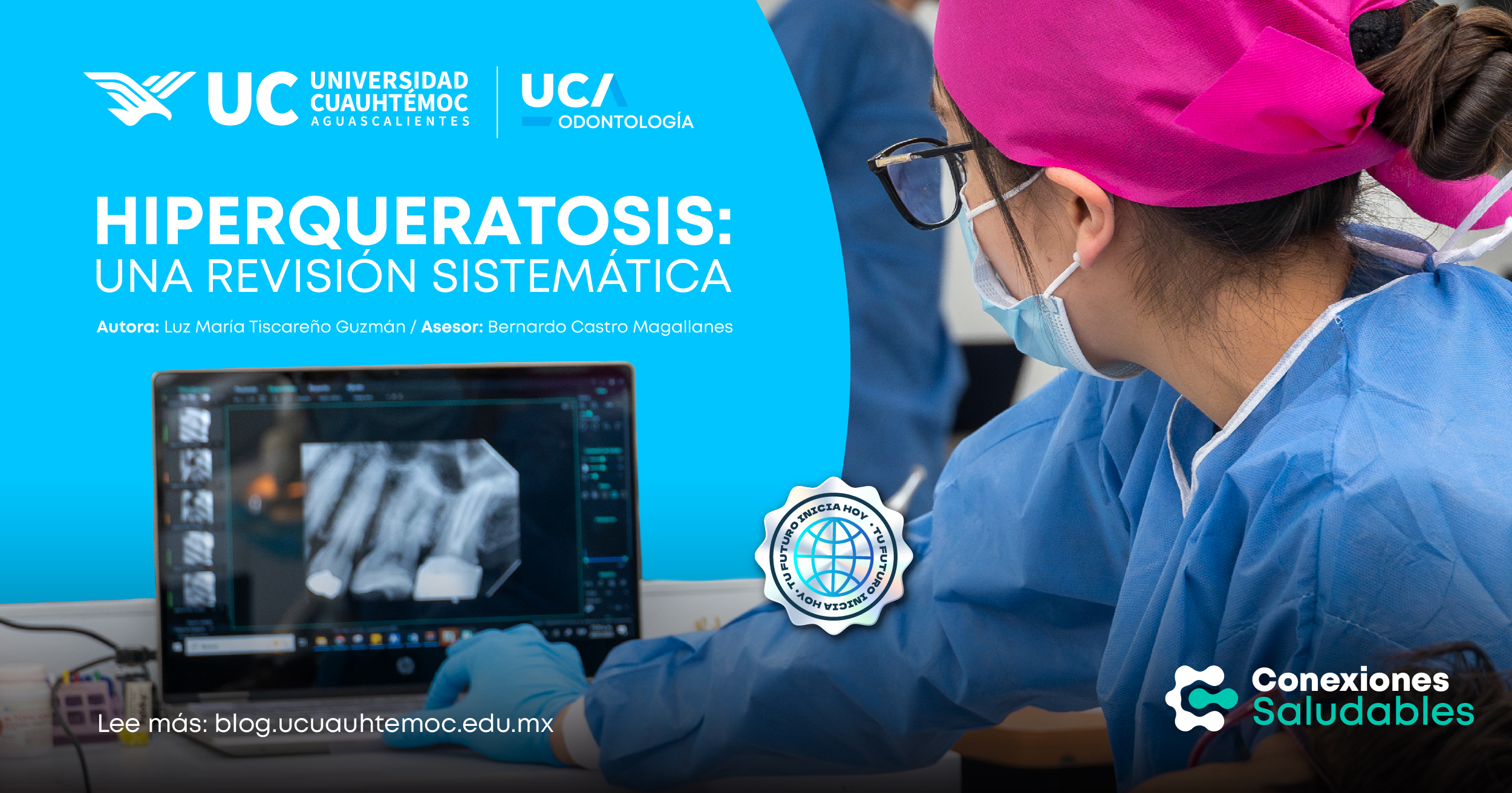 Hiperqueratosis: Una Revisión Sistemática